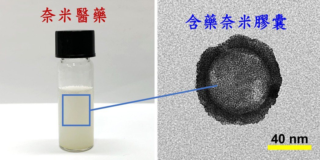長庚大學研發「雙功能長效型奈米載體」 可持續精準給藥治療青光眼-3.jpg